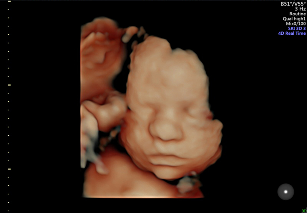 My Baby Scan Burscough 2d scan, 4d baby scan, gender reveal private scan