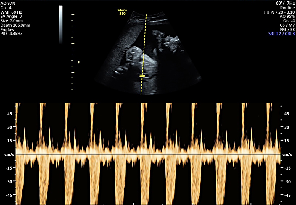 My Baby Scan Burscough 2d scan, 4d baby scan, gender reveal private scan